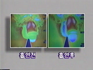 남자들 담배 피우지 말아야 하는 이유(다큐) | 인스티즈