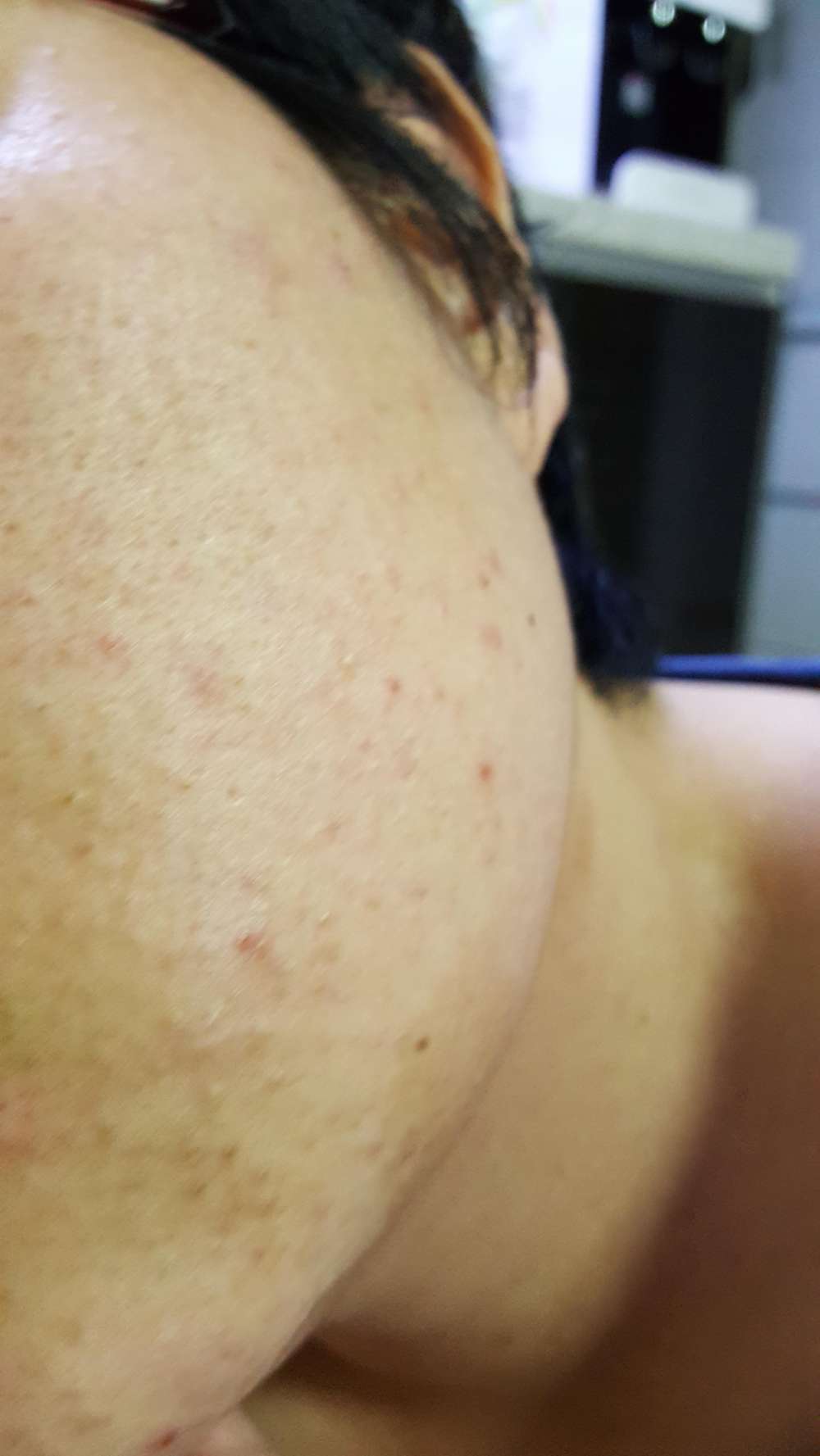 20171207_205905.jpg
